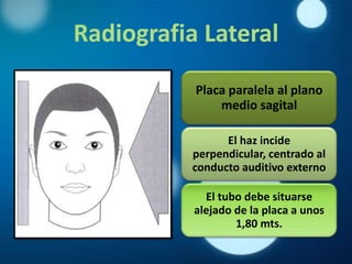 Radiografia Lateral

           Placa paralela al plano
               medio sagital

                 El haz incide
           perpendicular, centrado al
           conducto auditivo externo

             El tubo debe situarse
           alejado de la placa a unos
                   1,80 mts.
 