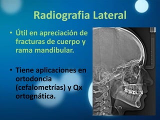 Radiografia Lateral
• Útil en apreciación de
  fracturas de cuerpo y
  rama mandibular.

• Tiene aplicaciones en
  ortodoncia
  (cefalometrías) y Qx
  ortognática.
 