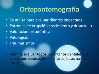 Ortopantomografía
•   Se utiliza para evaluar dientes impactaos
•   Patrones de erupción crecimiento y desarrollo
•   Valoración ortodóntica
•   Patologías
•   Traumatismos

• Permite evaluar todos los órganos dentales a la
  vez, senos paranasales maxilares, fosas nasales
  , ATM.
 