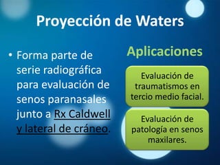 Proyección de Waters

• Forma parte de         Aplicaciones
  serie radiográfica        Evaluación de
  para evaluación de      traumatismos en
  senos paranasales      tercio medio facial.
  junto a Rx Caldwell      Evaluación de
  y lateral de cráneo.   patología en senos
                             maxilares.
 