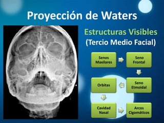 Proyección de Waters
          Estructuras Visibles
          (Tercio Medio Facial)
              Senos         Seno
             Maxilares     Frontal




                            Seno
              Orbitas
                          Etmoidal




             Cavidad        Arcos
              Nasal      Cigomáticos
 