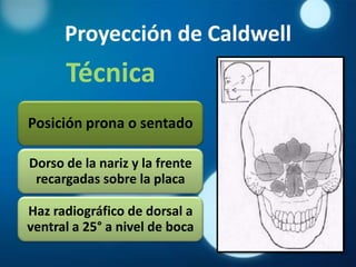 Proyección de Caldwell
      Técnica
Posición prona o sentado

Dorso de la nariz y la frente
 recargadas sobre la placa

Haz radiográfico de dorsal a
ventral a 25° a nivel de boca
 