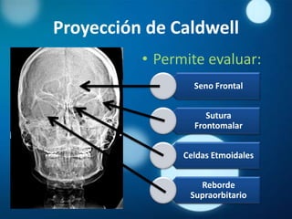 Proyección de Caldwell
          • Permite evaluar:
                  Seno Frontal


                     Sutura
                  Frontomalar


                Celdas Etmoidales


                   Reborde
                 Supraorbitario
 