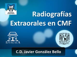 Radiografías
Extraorales en CMF


 C.D. Javier González Bello
 
