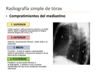 Radiografía simple de tórax
 Compratimientos del mediastino
 