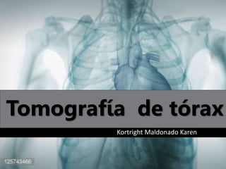 Tomografía de tórax
Kortright Maldonado Karen
 
