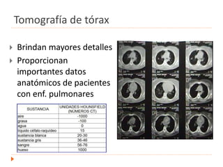  Brindan mayores detalles
 Proporcionan
importantes datos
anatómicos de pacientes
con enf. pulmonares
Tomografía de tórax
 