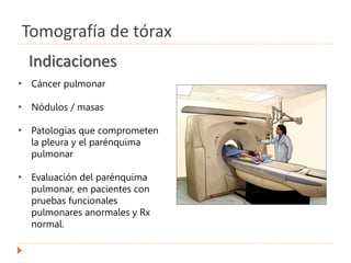 Indicaciones
• Cáncer pulmonar
• Nódulos / masas
• Patologías que comprometen
la pleura y el parénquima
pulmonar
• Evaluación del parénquima
pulmonar, en pacientes con
pruebas funcionales
pulmonares anormales y Rx
normal.
Tomografía de tórax
 