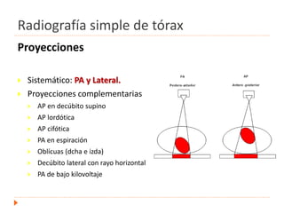 Radiografía simple de tórax
Proyecciones
 Sistemático: PA y Lateral.
 Proyecciones complementarias
 AP en decúbito supino
 AP lordótica
 AP cifótica
 PA en espiración
 Oblícuas (dcha e izda)
 Decúbito lateral con rayo horizontal
 PA de bajo kilovoltaje
 