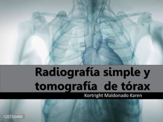 Radiografía simple y
tomografía de tórax
Kortright Maldonado Karen
 