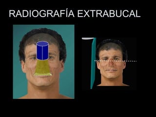 RADIOGRAFÍA EXTRABUCAL 