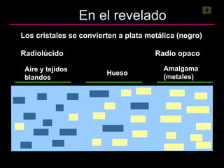 En el revelado 0 Aire y tejidos  blandos Hueso Amalgama  (metales) Los cristales se convierten a plata metálica (negro) Radiolúcido Radio opaco 