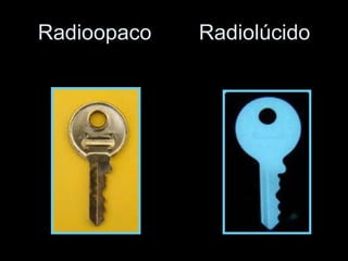 Radioopaco  Radiolúcido 