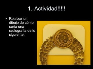 1.-Actividad!!!!! Realizar un dibujo de cómo sería una radiografía de lo siguiente: 