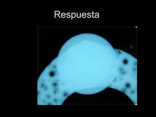 Respuesta  