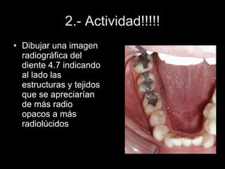 2.- Actividad!!!!! Dibujar una imagen radiográfica del diente 4.7 indicando al lado las estructuras y tejidos que se apreciarían de más radio opacos a más radiolúcidos 