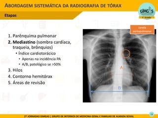 2as JORNADAS GIMGAS | GRUPO DE INTERNOS DE MEDICINA GERAL E FAMILIAR DE ALMADA SEIXAL
ABORDAGEM SISTEMÁTICA DA RADIOGRAFIA DE TÓRAX
Etapas
A
B
1. Parênquima pulmonar
2. Mediastino (sombra cardíaca,
traqueia, brônquios)
• Índice cardiotorácico
• Apenas na incidência PA
• A/B, patológico se >50%
3. Hilos
4. Contorno hemitórax
5. Áreas de revisão
Janela
aortopulmonar
13
 