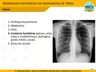 2as JORNADAS GIMGAS | GRUPO DE INTERNOS DE MEDICINA GERAL E FAMILIAR DE ALMADA SEIXAL
1. Parênquima pulmonar
2. Mediastino
3. Hilos
4. Contorno hemitórax (pleura, seios
costo e cardiofrénicos, diafragma,
partes moles, ossos)
5. Áreas de revisão
ABORDAGEM SISTEMÁTICA DA RADIOGRAFIA DE TÓRAX
Etapas
15
 