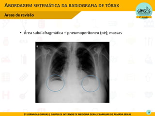 2as JORNADAS GIMGAS | GRUPO DE INTERNOS DE MEDICINA GERAL E FAMILIAR DE ALMADA SEIXAL
• Área subdiafragmática – pneumoperitoneu (pé); massas
ABORDAGEM SISTEMÁTICA DA RADIOGRAFIA DE TÓRAX
Áreas de revisão

19
 