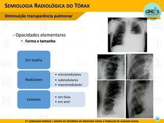 2as JORNADAS GIMGAS | GRUPO DE INTERNOS DE MEDICINA GERAL E FAMILIAR DE ALMADA SEIXAL
- Opacidades elementares
• Forma e tamanho
SEMIOLOGIA RADIOLÓGICA DO TÓRAX
Diminuição transparência pulmonar
Em toalha
• micronodulares
• subnodulares
• macronodulares
Nodulares
• em faixa
• em anel
Lineares
28
 