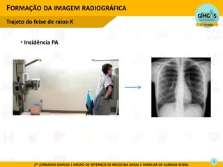 2as JORNADAS GIMGAS | GRUPO DE INTERNOS DE MEDICINA GERAL E FAMILIAR DE ALMADA SEIXAL
FORMAÇÃO DA IMAGEM RADIOGRÁFICA
Trajeto do feixe de raios-X
3
• Incidência PA
 