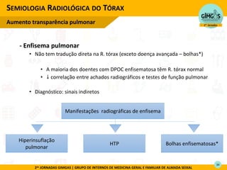 2as JORNADAS GIMGAS | GRUPO DE INTERNOS DE MEDICINA GERAL E FAMILIAR DE ALMADA SEIXAL
- Enfisema pulmonar
• Não tem tradução direta na R. tórax (exceto doença avançada – bolhas*)
• A maioria dos doentes com DPOC enfisematosa têm R. tórax normal
•  correlação entre achados radiográficos e testes de função pulmonar
• Diagnóstico: sinais indiretos
SEMIOLOGIA RADIOLÓGICA DO TÓRAX
Aumento transparência pulmonar
Hiperinsuflação
pulmonar
HTP Bolhas enfisematosas*
Manifestações radiográficas de enfisema
34
 
