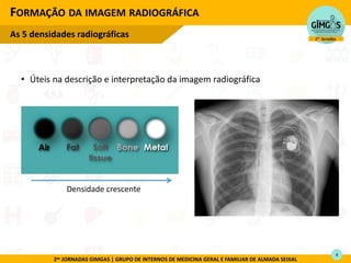 2as JORNADAS GIMGAS | GRUPO DE INTERNOS DE MEDICINA GERAL E FAMILIAR DE ALMADA SEIXAL
FORMAÇÃO DA IMAGEM RADIOGRÁFICA
As 5 densidades radiográficas
4
Densidade crescente
• Úteis na descrição e interpretação da imagem radiográfica
 