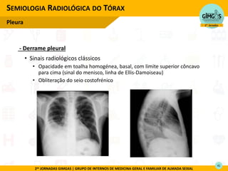 2as JORNADAS GIMGAS | GRUPO DE INTERNOS DE MEDICINA GERAL E FAMILIAR DE ALMADA SEIXAL
- Derrame pleural
• Sinais radiológicos clássicos
• Opacidade em toalha homogénea, basal, com limite superior côncavo
para cima (sinal do menisco, linha de Ellis-Damoiseau)
• Obliteração do seio costofrénico
SEMIOLOGIA RADIOLÓGICA DO TÓRAX
Pleura
41
 