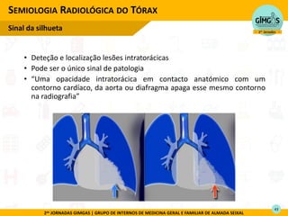 2as JORNADAS GIMGAS | GRUPO DE INTERNOS DE MEDICINA GERAL E FAMILIAR DE ALMADA SEIXAL
• Deteção e localização lesões intratorácicas
• Pode ser o único sinal de patologia
• U a opacidade intratorácica em contacto anatómico com um
contorno cardíaco, da aorta ou diafragma apaga esse mesmo contorno
na adiog afia
SEMIOLOGIA RADIOLÓGICA DO TÓRAX
Sinal da silhueta
43
 