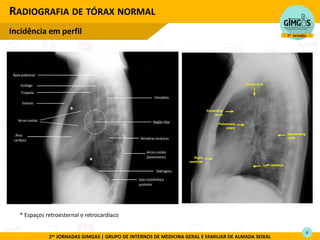 2as JORNADAS GIMGAS | GRUPO DE INTERNOS DE MEDICINA GERAL E FAMILIAR DE ALMADA SEIXAL
RADIOGRAFIA DE TÓRAX NORMAL
Incidência em perfil
6
*
*
* Espaços retroesternal e retrocardíaco
 