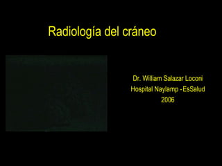 Radiología del cráneo Dr. William Salazar Loconi Hospital Naylamp - EsSalud 2006 