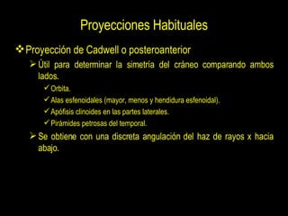 Proyecciones Habituales <ul><li>Proyección de Cadwell o posteroanterior </li></ul><ul><ul><li>Útil para determinar la sime...