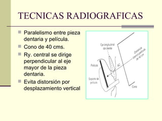 TECNICAS RADIOGRAFICAS
 Paralelismo entre pieza
dentaria y película.
 Cono de 40 cms.
 Ry. central se dirige
perpendicular al eje
mayor de la pieza
dentaria.
 Evita distorsión por
desplazamiento vertical
 