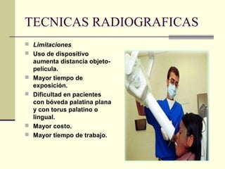 TECNICAS RADIOGRAFICAS
 Limitaciones
 Uso de dispositivo
aumenta distancia objeto-
película.
 Mayor tiempo de
exposición.
 Dificultad en pacientes
con bóveda palatina plana
y con torus palatino o
lingual.
 Mayor costo.
 Mayor tiempo de trabajo.
 