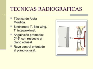 TECNICAS RADIOGRAFICAS
 Técnica de Aleta
Mordida.
 Sinónimos: T. Bite wing,
T. interproximal.
 Angulación promedio:
0º-8º con respecto al
plano oclusal.
 Rayo central orientado
al plano oclusal.
 