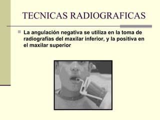 TECNICAS RADIOGRAFICAS
 La angulación negativa se utiliza en la toma de
radiografías del maxilar inferior, y la positiva en
el maxilar superior
 
