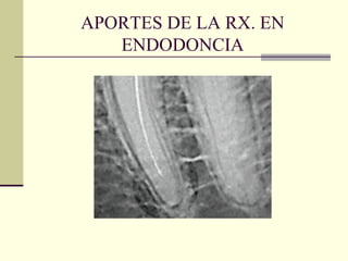 APORTES DE LA RX. EN
ENDODONCIA
 