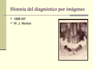 Historia del diagnóstico por imágenes
 1896 NY
 W. J. Morton
 