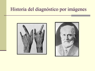 Historia del diagnóstico por imágenes
 