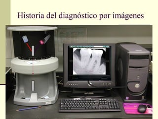 Historia del diagnóstico por imágenes
 