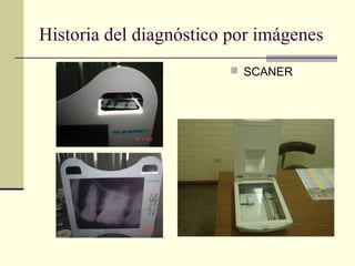 Historia del diagnóstico por imágenes
 SCANER
 