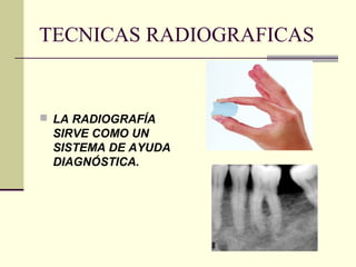 TECNICAS RADIOGRAFICAS
 LA RADIOGRAFÍA
SIRVE COMO UN
SISTEMA DE AYUDA
DIAGNÓSTICA.
 