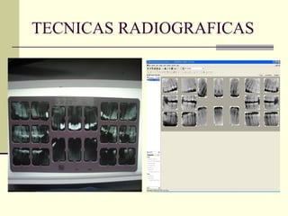 TECNICAS RADIOGRAFICAS
 