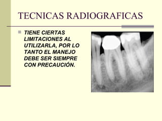 TECNICAS RADIOGRAFICAS
 TIENE CIERTAS
LIMITACIONES AL
UTILIZARLA, POR LO
TANTO EL MANEJO
DEBE SER SIEMPRE
CON PRECAUCIÓN.
 