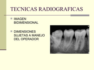 TECNICAS RADIOGRAFICAS
 IMAGEN
BIDIMENSIONAL
 DIMENSIONES
SUJETAS A MANEJO
DEL OPERADOR
 