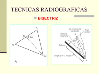 TECNICAS RADIOGRAFICAS
 BISECTRIZ
 