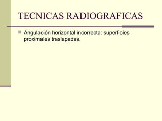TECNICAS RADIOGRAFICAS
 Angulación horizontal incorrecta: superficies
proximales traslapadas.
 