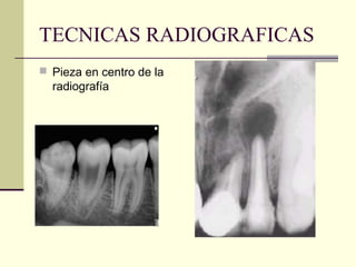 TECNICAS RADIOGRAFICAS
 Pieza en centro de la
radiografía
 