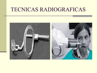 TECNICAS RADIOGRAFICAS
 