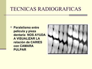 TECNICAS RADIOGRAFICAS
 Paralelismo entre
película y pieza
dentaria NOS AYUDA
A VISUALIZAR LA
relación de CARIES
con CAMARA
PULPAR
 